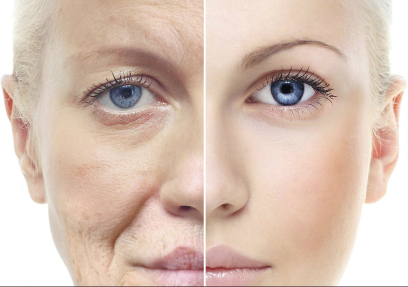 Эффективные средства анти-эйдж для кожи лица - лучшая косметика против старения