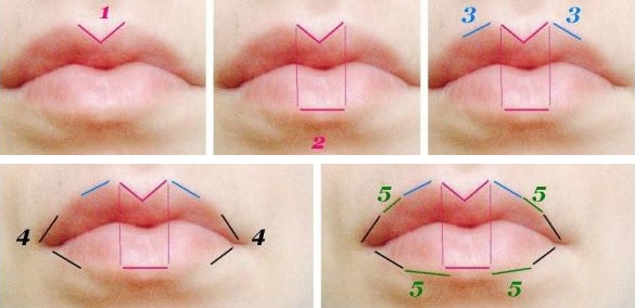 Исправление асимметрии губ