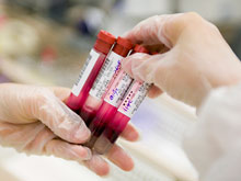Расшифровка анализа крови беременных