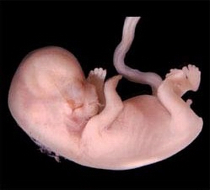 Как выглядит плод на 10 11 неделе беременности фото
