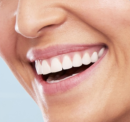 Красивая улыбка здоровых зубов