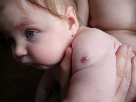 Прививки ребенку в роддоме
