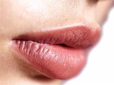 Что вызывает трещины и ранки на губах? 