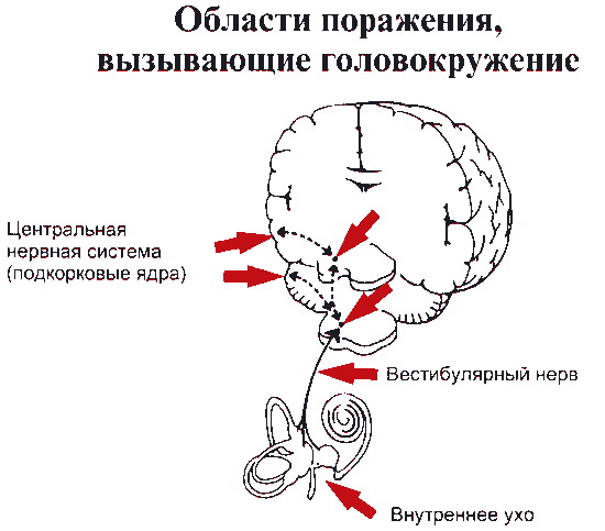 Голова кружится при заболеваниях головного мозга и органов головы