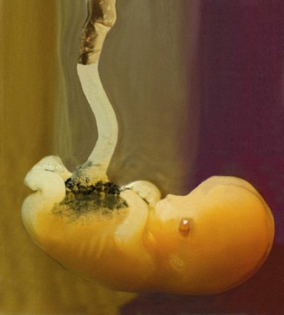 Курение при беременности