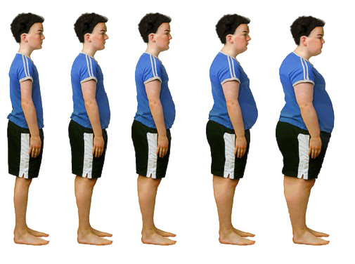 Чем опасно ожирение у детей